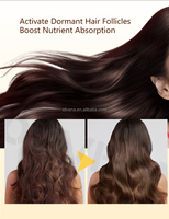 Minyak Herbal OTVENA untuk Pertumbuhan Rambut, untuk Rambut Keriting, Berminyak, dan Semua Jenis Rambut