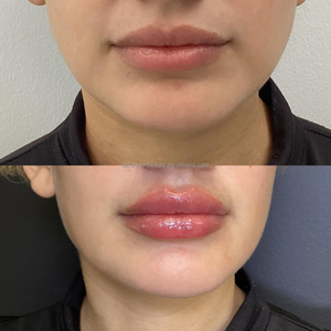 15 ml Black Squeeze Volumen máximo <span class=keywords><strong>de</strong></span> <span class=keywords><strong>labios</strong></span> Efecto fuerte Lip Plumper Lip Volumizer con etiqueta privada - Product Image 6