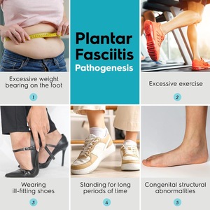 Calzino Ortopedico Notturno per Fascite Plantare - Morbido Stretcher per Fascia Plantare, Supporto per Tendiniti di Achille, Sollievo dal Dolore durante il Sonno - Product Image 5