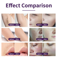 Huamei 2025 nouveau 2 en 1 Diode Laser épilation Machine élimination des taches de rousseur élimination de l'acné rides rajeunissement de la peau IPL