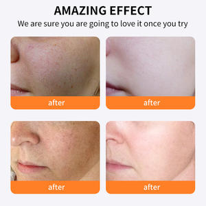 Crème éclaircissante <span class=keywords><strong>anti</strong></span>-taches à la vitamine C en gros, produits cosmétiques de beauté, crème pour le <span class=keywords><strong>visage</strong></span> à la vitamine C - Product Image 3