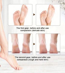 Rechargeable Electric Callus Remover Cordless Multi-Function Portable Foot <b>File</b> Removes Dry Coarse Skin Calluses Heels for Women - Product Image 4