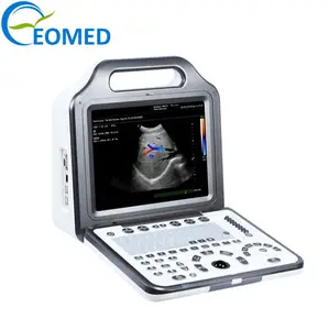 저렴한 가격 임상 초음파 스캐너 컬러 도플러 초음파 진단 시스템 기계 2 프로브 커넥터 CU20