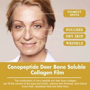 Nhãn hiệu riêng Logo Hữu Cơ collagen hyaluronic axit chống nhăn làm săn chắc làn da mịn màng dưỡng ẩm mặt phun chất - Product Image 2