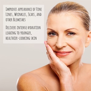 Crema para Estrías OEM NUEVA de 30 ml, Crema Reparadora para Estrías, Crema Exfoliante, la Mejor Crema para Estrías - Product Image 4