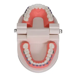 歯科矯正治療モデルを備えたOrthoMetalセラミックブラケット矯正歯科歯モデル