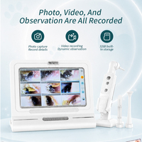 Caméra d'inspection de l'oreille et de la gorge Meiboyi 11 pouces HD, endoscope électronique portable pour le nettoyage des oreilles des animaux