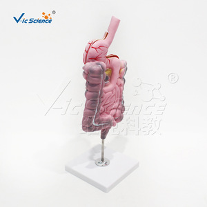 Modèle de pathologie du système digestif humain avec une structure anatomique claire ; un modèle pédagogique pratique pour les écoles de médecine. - Product Image 3