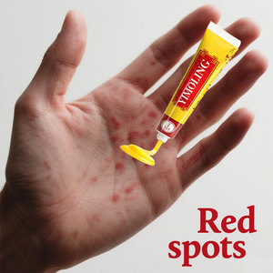 습진 및 발 가려움증의 즉각적인 완화 천연 허브 포뮬러 억제 포도상 구균 및 칸디다 항균 가려움증 크림 - Product Image 2