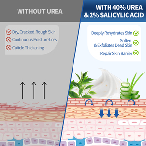 <span class=keywords><strong>Crema</strong></span> de <span class=keywords><strong>urea</strong></span> de 8.8 oz con etiqueta privada personalizada, <span class=keywords><strong>40</strong></span> <span class=keywords><strong>por</strong></span> <span class=keywords><strong>ciento</strong></span> para pies, máxima potencia, con 2 <span class=keywords><strong>por</strong></span> <span class=keywords><strong>ciento</strong></span> de ácido salicílico, <span class=keywords><strong>crema</strong></span> para pies con <span class=keywords><strong>urea</strong></span> - Product Image 6