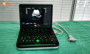 Mới nhất giá rẻ y tế máy tính xách tay bệnh viện OB gyn máy siêu âm 15.6 inch màn hình xách tay usg <span class=keywords><strong>Scanner</strong></span> - Product Image 4