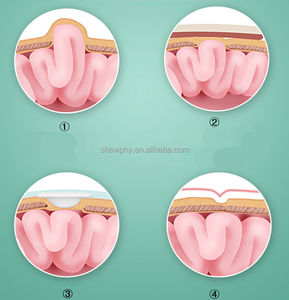 Sabuk Hernia umbilikal bayi 3 bantalan bahan lembut pita pendukung tali penutup luka transparan desain nyaman - Product Image 5