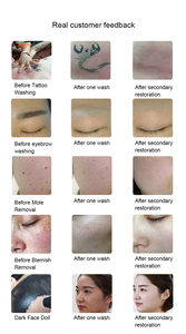 Láser Nd Yag Q-Switched al por mayor 1064nm 532nm 1320nm para eliminación de tatuajes de cejas para salones de belleza - Product Image 5