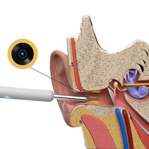 Bebird R1 inalámbrico portátil recargable limpiador <span class=keywords><strong>de</strong></span> oído endoscopio cera <span class=keywords><strong>limpieza</strong></span> P 3 con 1080 millones <span class=keywords><strong>de</strong></span> píxeles - Product Image 1