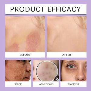 Zephoco Chất Lượng Cao Hot Bán Đa Màu Sắc Hydrate Ánh Sáng Và Lâu Dài Kem Che Khuyết Điểm Sáng Và Kem Che Khuyết Điểm Bột - Product Image 6