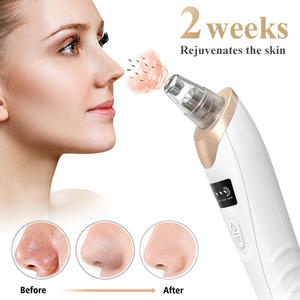 Hot Sale Electric <strong>Blackhead</strong> <strong>Remover</strong> Low Price Pore Deep Cleaning <strong>Tool</strong> with Vacuum Suction Technology - Product Image 3