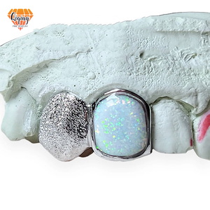 Haute qualité Offre Spéciale S925 argent Sterling Grillz Dente glacé émail Moissanite diamant <span class=keywords><strong>dents</strong></span> Grillz Hip Hop bijoux - Product Image 1