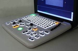Mesin Pemindai <span class=keywords><strong>Ultrasound</strong></span> Laptop Portabel Penyimpanan Besar Layar Besar Mesin <span class=keywords><strong>Ultrasound</strong></span> Doppler Warna untuk Sapi - Product Image 5