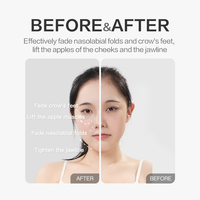 Dispositivo de Belleza para Lifting Facial, Reafirmante y Contorneador, para Uso Doméstico, Portátil, Antiarrugas, con 30 Almohadillas de Repuesto