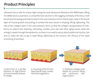 Appareil de raffermissement cutané 2D, idéal pour le lifting du visage, raffermissant cutané 2D, réduction des rides, remodelage du visage - Product Image 5