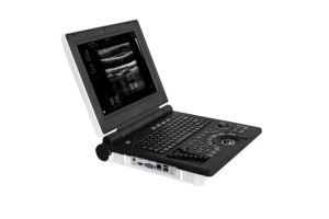 Mesin USG Medis Portabel 3D Warna Doppler Terbaru <span class=keywords><strong>2026</strong></span> - Product Image 3