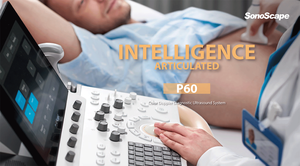 <span class=keywords><strong>Sonoscape</strong></span> P Serie P9/P10/P15/P20/P40/P50/P60 Trolley Kleur Doppler Systeem Echografie Machine - Product Image 2