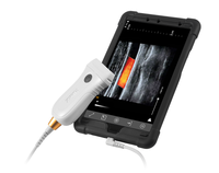 Échographie médicale à ultrasons USB Sonde à ultrasons linéaire convexe Intelligent B/W Couleur Doppler App basé POC Échographie portable