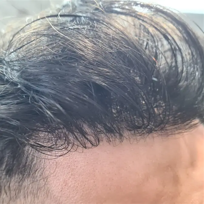 Stock Gute Qualität Natürlicher Haaransatz Mann Perücken Haars ystem Natürliches 100% Echthaar Toupee Für Männer