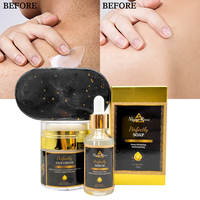Meilleures Ventes : Produits de Soin pour la Peau Éliminant les Taches Brunes, Savon Noir Africain, Crème Éclaircissante au Curcuma – Coffret Complet de Soin pour la Peau