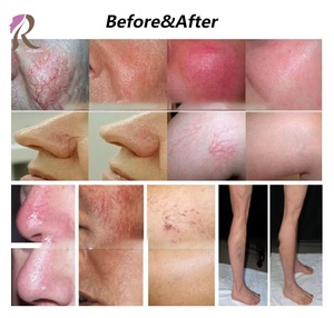 Depiladora Eléctrica para Mujer, Depiladora de <span class=keywords><strong>Cejas</strong></span>, Último Modelo en Depilación Facial, Venta Caliente - Product Image 6