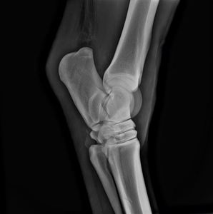 SY-D4343-1医療用17x17インチマンモグラフィデジタルフラットパネル検出器CSIDrパネル検出器 - Product Image 3