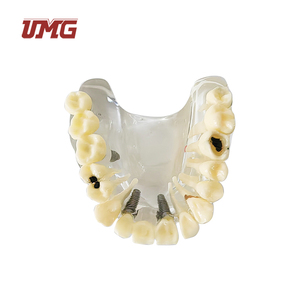 Modelo de Dientes de Práctica para Implantes Dentales UMG UM-2006, Mandíbula Inferior, para Incisión y Perforación, Calidad Superior Duradera - Product Image 4