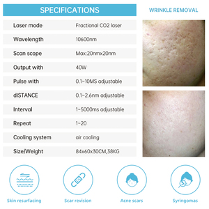Élimination professionnelle des cicatrices et des marques USA Dispositif <span class=keywords><strong>laser</strong></span> cohérent <span class=keywords><strong>Laser</strong></span> fractionnel C02 RF Tube - Product Image 6