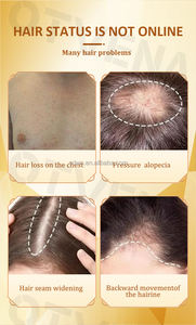 Huile <span class=keywords><strong>de</strong></span> croissance des cheveux OTVENA - Réduit <span class=keywords><strong>la</strong></span> perte <span class=keywords><strong>de</strong></span> cheveux et stimule <span class=keywords><strong>la</strong></span> croissance - Service OEM disponible - Product Image 3