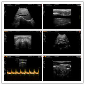 Meilleure vente Ordinateur portable médical gratuit 3D Chien chat Lapin Doppler Portable Échographie Machine à ultrasons - Product Image 2