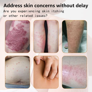 Krim Kesehatan Kulit Sensitif Alami Murni, Salep Kulit Antibakteri, Formula Herbal Alami Cepat Atasi Gatal, Salep Kulit - Product Image 3