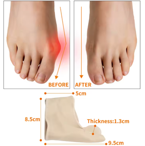 Meilleures ventes 2026, prix d'usine, coussinets métatarsiens en gel souple, <span class=keywords><strong>correcteur</strong></span> d'<span class=keywords><strong>hallux</strong></span> <span class=keywords><strong>valgus</strong></span>, kit de traitement pour soulager la douleur du gros orteil - Product Image 4