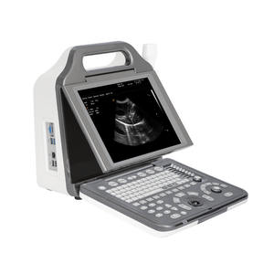 Appareil d'échographie portable noir et <span class=keywords><strong>blanc</strong></span> MR-N5 pour animaux de compagnie (chats, chiens, vaches) pour clinique vétérinaire - Product Image 2