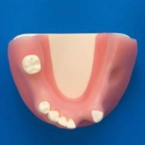 Modelo Dental Star con Dientes Faltantes 55-2 para Uso Educativo - Product Image 1