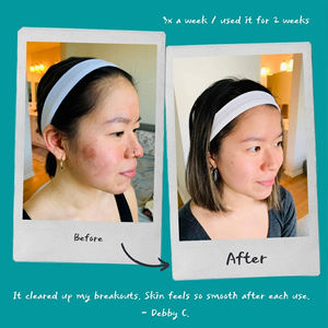 Gommage nettoyant et blanchissant pour le visage et le corps, végan, concombre, chou frisé, crème exfoliante pour le nettoyage du visage et du corps à base de plantes - Product Image 4