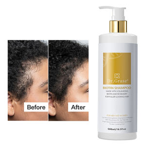 Ensemble de soins capillaires à la biotine biologique avec logo personnalisé, shampooing professionnel <span class=keywords><strong>anti</strong></span>-<span class=keywords><strong>chute</strong></span> de cheveux et stimulant la pousse des cheveux - Product Image 1