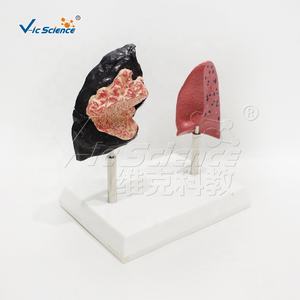 Modelo anatómico médico para la Educación para la prevención del tabaquismo modelo <span class=keywords><strong>de</strong></span> pulmones comparación hombre fumador saludable educación científica médica - Product Image 5