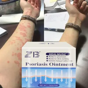 ZB Psoriasis Cream For Dermatitis And Eczema Herbal Medicine Ointment Anti-Itching Antibacterial Eczema Skin Care Cream