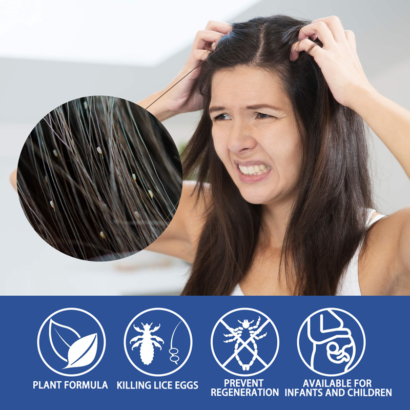 30ml scabies lice spray head lice flea tick louse egg removing itch redness swelling treatment spray