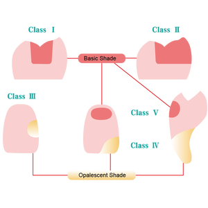 High Quality 4g/box Dental Filling <strong>Composite</strong> Dental Nano Hybrid <strong>Light</strong> <strong>Curing</strong> Universal <strong>Composite</strong> <strong>Resin</strong> - Product Image 6