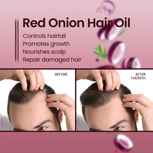 Private Label Gentle Red <strong>Onion</strong> <strong>Hair</strong> Growth <strong>Oil</strong> Indian Premium Repair Damaged Scalp Thicker Fuller Treatment <strong>Onion</strong> <strong>Hair</strong> <strong>Oil</strong> - Product Image 4