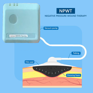 NPWTマイナス圧力創傷治療使い捨てマイナス圧力排水創傷ケアドレッシングNPWTドレッシングキット - Product Image 4