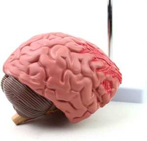 GelsonLab HSBM-564 Modelo de Cerebro Tipo Maniquí para Epilepsia, Hemorragia Cerebral y Patología de Malformación Arteriovenosa - Product Image 6