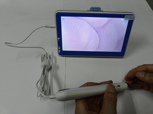 Limpiador de Oídos Inteligente con Endoscopio HD Eléctrico, Cuchara Digital para Remover Cera de Oídos con Microscopio, Limpiador Visual de Oídos - Product Image 4