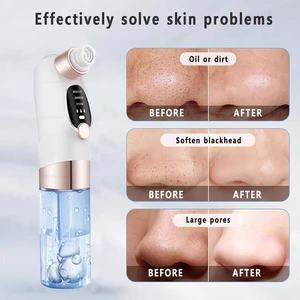 Limpiador Facial Eléctrico Portátil USB-C <span class=keywords><strong>de</strong></span> Succión <span class=keywords><strong>de</strong></span> Puntos Negros y Acné con Microburbujas, el Más Vendido - Product Image 1